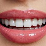 بهترین لبخند سلبریتی ها