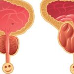 تشخیص و درمان بیماری‌های پروستات توسط متخصص اورولوژی