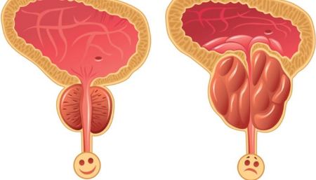 تشخیص و درمان بیماری‌های پروستات توسط متخصص اورولوژی