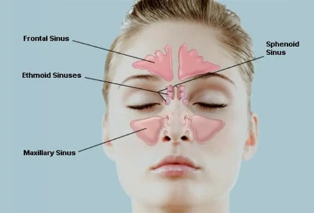 تخلیه سینوس در خانه, باز کردن شیپور استاش