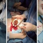 ماجرای ترسناک «خرمالو» در اتاق‌های عمل مشهد