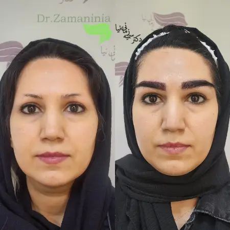 مدل های کاشت ابرو 2025