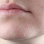 چگونه از خشکی و ترک پوست در نواحی مختلف بدن جلوگیری کنیم؟