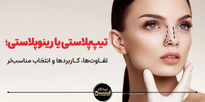 تیپ پلاستی یا رینوپلاستی