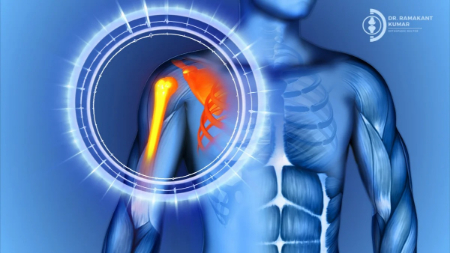 درد شانه شبانه, علت درد شانه در شب