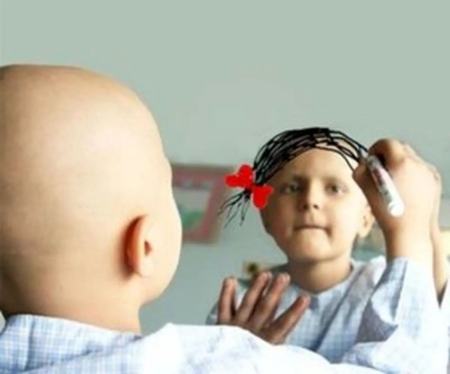 وزارت بهداشت: در برخی سرطان‌ها موارد ابتلا در سنین پایین‌تر بیشتر شده است