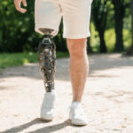 پروتز پا؛ از چوب قدیمی تا ربات‌هایی که مثل پای واقعی راه می‌روند!