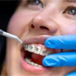 آیا ارتودنسی باعث تغییر فک می‌شود؟