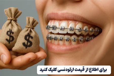 قیمت ارتودنسی