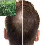 این گیاه می‌تواند کلید رشد مجدد مو باشد