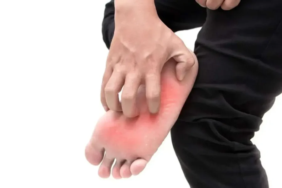 خارش کف پا؛ مشکل کوچک یا نشانه بیماری جدی؟