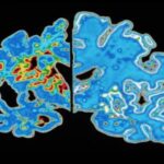 دانشمندان «ساعت آلزایمر» ساختند