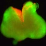 دستاوردی قابل توجه در ترمیم نخاع