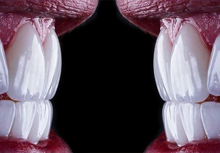 جایگزین‌های مناسب؛ اگر لمینت برای من مناسب نیست، چه کنم؟