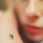 عفونت پوستی ناشی از نیش حشرات: علل ، علائم و درمان