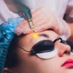 عوارض پاک کردن تاتو ابرو با لیزر {5 عوارض مهم و تجربی}