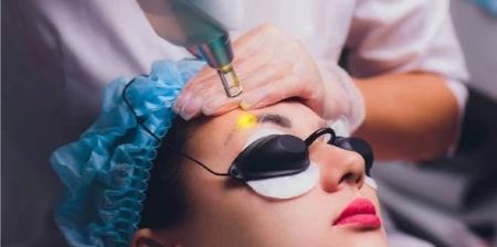 عوارض پاک کردن تاتو ابرو با لیزر {5 عوارض مهم و تجربی}