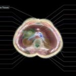 اسکن بدن بدون نیاز به دستگاه MRI / پروژه بلندپروازانه «میدجرنی مدیکال»