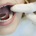 مطالعه: کمبود ویتامین K و مصرف زیاد ویتامین D با افزایش خطر پوسیدگی دندان مرتبط است
