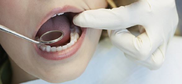 مطالعه: کمبود ویتامین K و مصرف زیاد ویتامین D با افزایش خطر پوسیدگی دندان مرتبط است