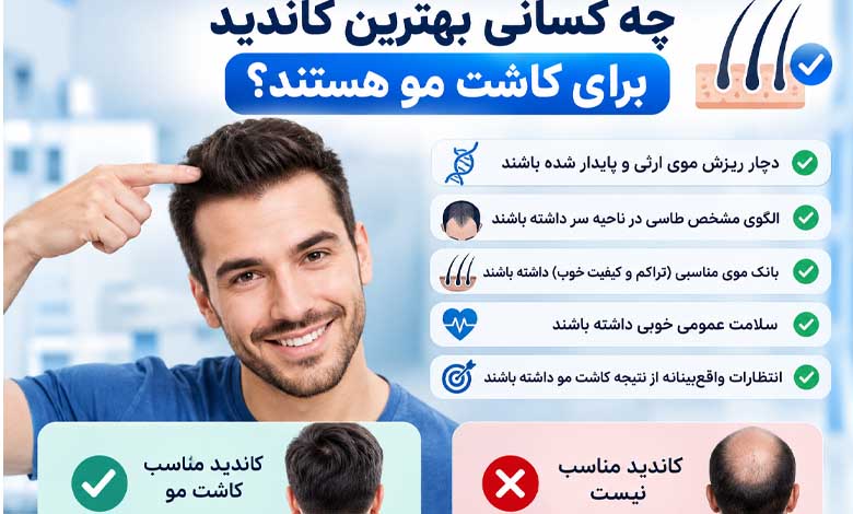 از کجا بفهمیم به کاشت مو نیاز داریم؟ چه کسانی بهترین کاندید برای کاشت مو هستند؟