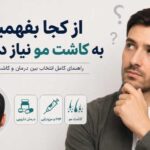از کجا بفهمیم به کاشت مو نیاز داریم