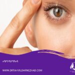 ۹ روش جوانسازی اطراف چشم و کاربرد هرکدام برای رفع علائم پیری