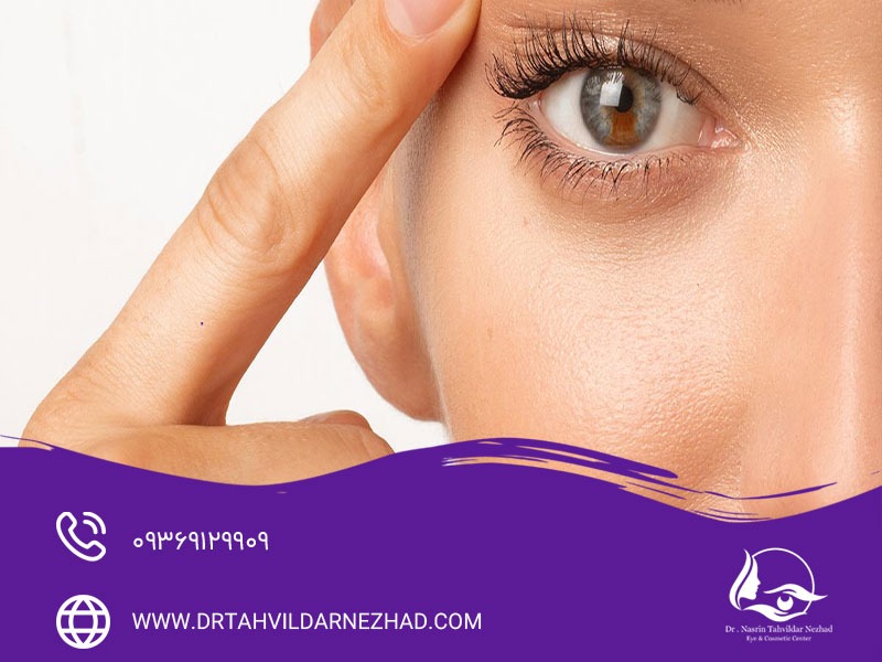 ۹ روش جوانسازی اطراف چشم و کاربرد هرکدام برای رفع علائم پیری