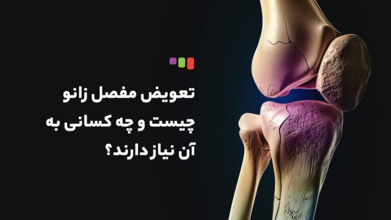 جراحی مفصل زانو + تعویض مفصل زانو