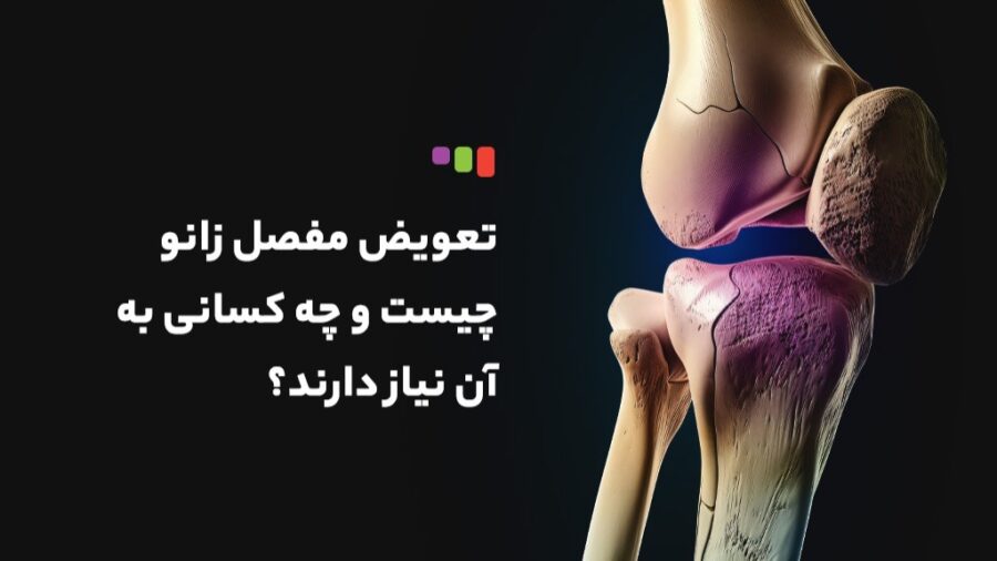 جراحی مفصل زانو + تعویض مفصل زانو