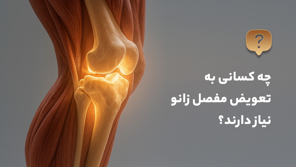 چه کسانی به تعویض مفصل زانو نیاز دارند؟
