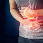 رفلاکس معده و توصیه‌های طب سنتی؛ کدام خوراکی‌ها علائم سوزش سر دل را تشدید می‌کنند؟