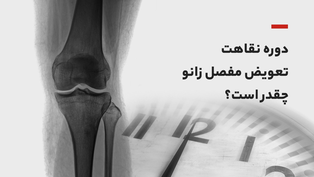 دوره نقاهت تعویض مفصل زانو چقدر است؟
