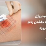 پانسمان هیدروژل چیست؟ مرطوب نگه داشتن زخم خشک و نکروزه