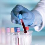خطر HPV کاملا جدی است؛ نگرانی یک ویروس شناس